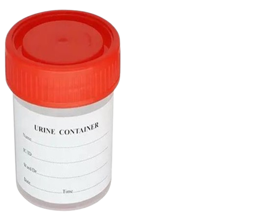 Container Urine 60ml (500's)