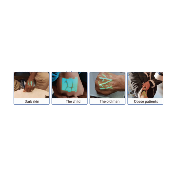 Vein Finder QV-500