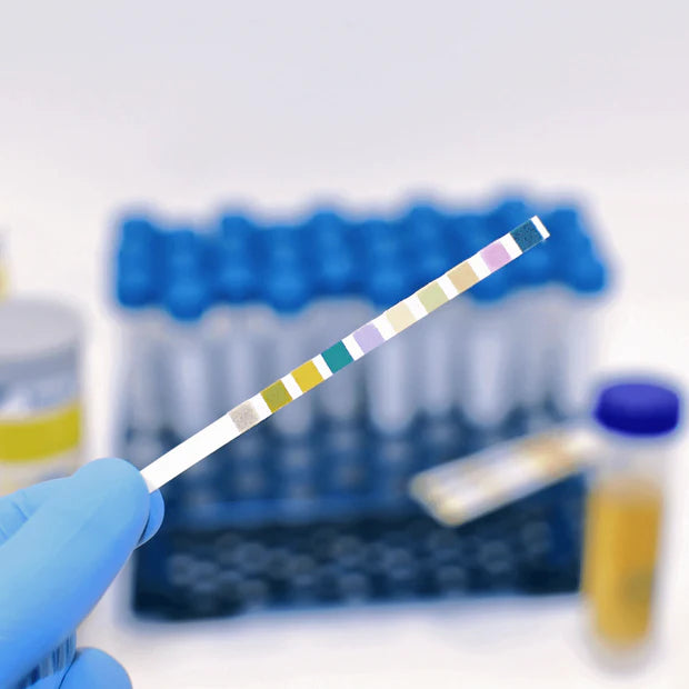 10P Urinalysis Test - 10-in-1 Parameter Urine Test